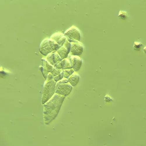fotografia urządzenie do pracy z kontrastem modulacyjnym Hoffmana MAGUS HCM360, z zestawem obiektywów,  14
