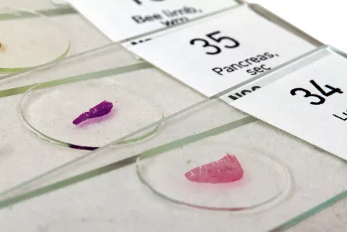 fotografia zestaw preparatów Levenhuk N80 NG „Zobacz wszystko”,  17