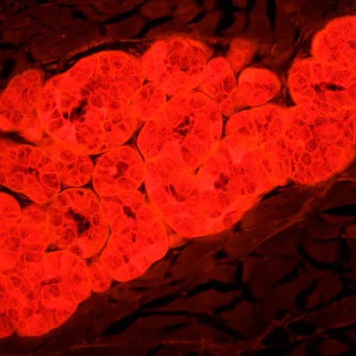 fotografia cyfrowy mikroskop fluorescencyjny MAGUS Lum D450L LCD,  32
