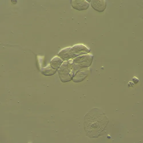 fotografia urządzenie do pracy z kontrastem modulacyjnym Hoffmana MAGUS HCM360, z zestawem obiektywów,  13